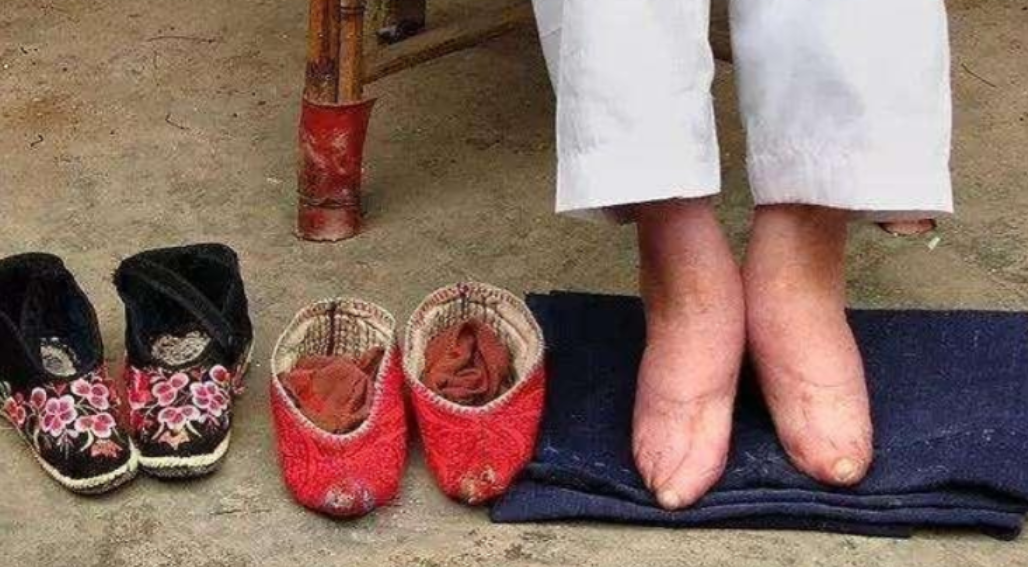 "最后一位"裹脚女性亲述:15岁靠三寸金莲嫁大户,洗脚过程煎熬