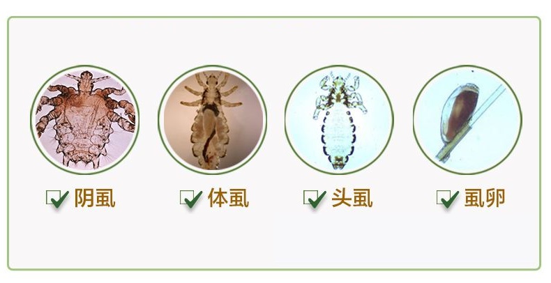 30年前男女老少都有虱子,为什么现在没有了?虱子都是从哪来的?