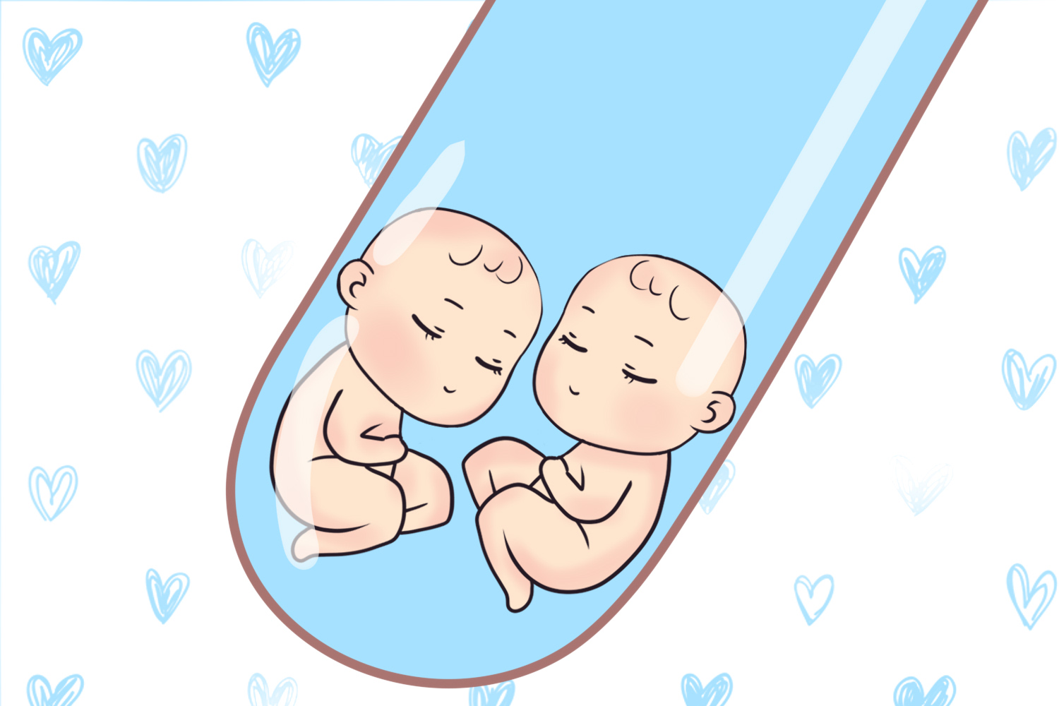 人工受孕双胞胎图片