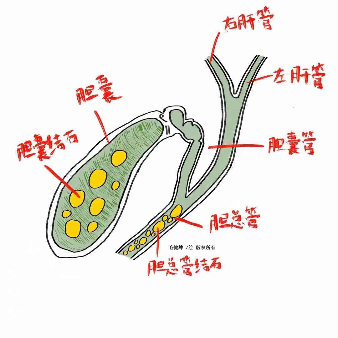 胆总管分为哪四段图片图片