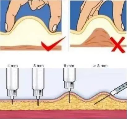 怀孕后腹部如何注射抗凝剂,这些您要了解