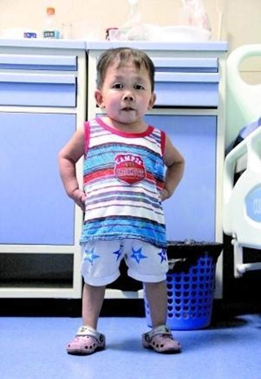 袖珍男子吴康33岁,面容和身高都停留在一岁时期,他如何养活自己