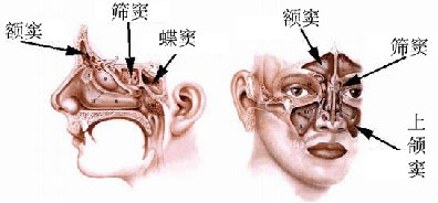 重庆中民耳鼻喉医院讲解,鼻窦炎反复发作会有什么危害?