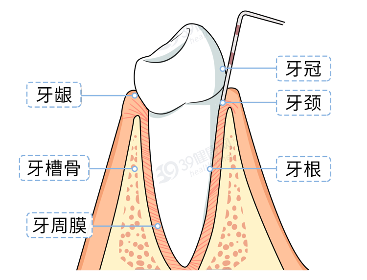 长期用牙签剔牙,对牙齿是好还是坏?教你正确剔牙的方法