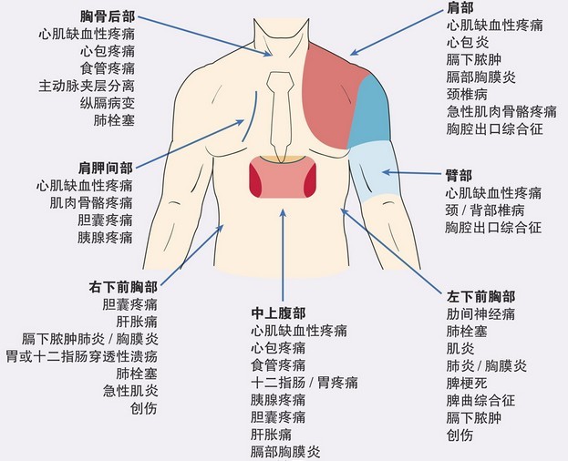 罕见疾病滑脱性肋骨综合症,初期发病的症状易被忽视,要积极治疗