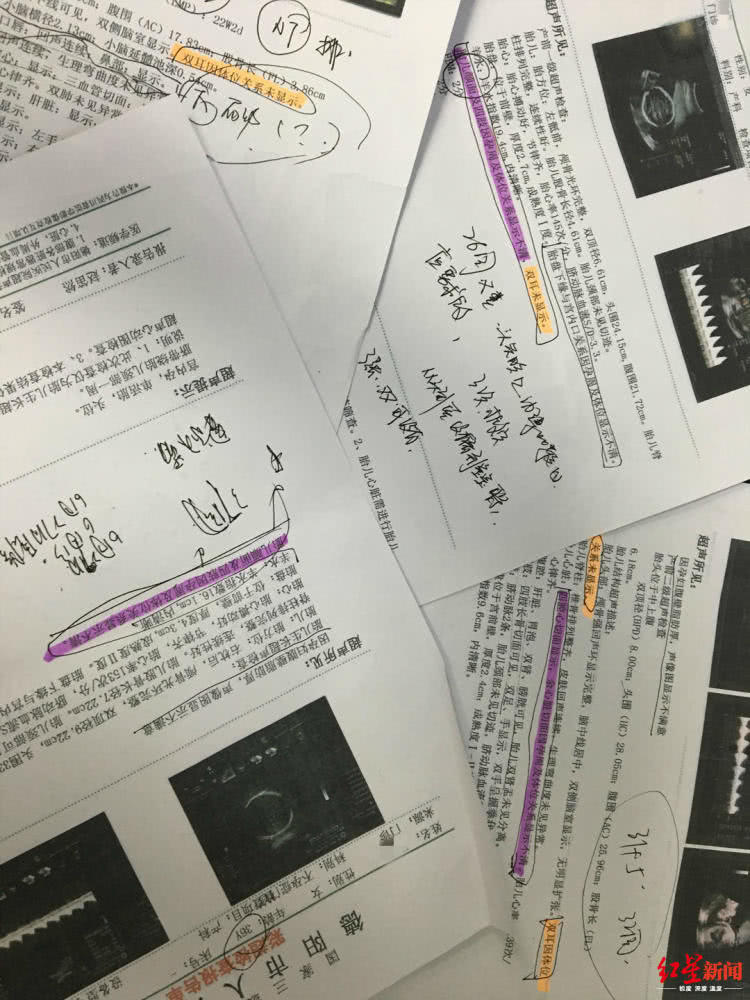 产检过却生下畸形儿,父亲:我不能把他带回家,带回去也养不活