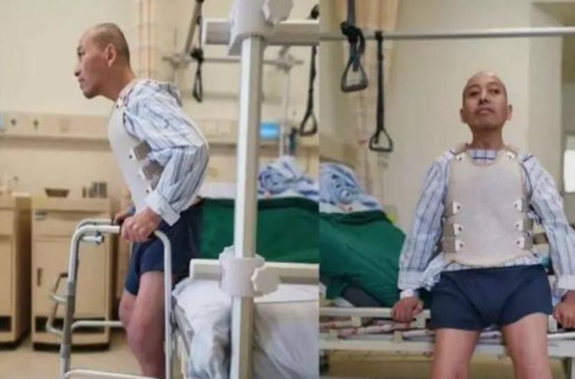 纪实"折叠人"李华:骨头被敲断4次,植入22颗钢钉,如今重获新生