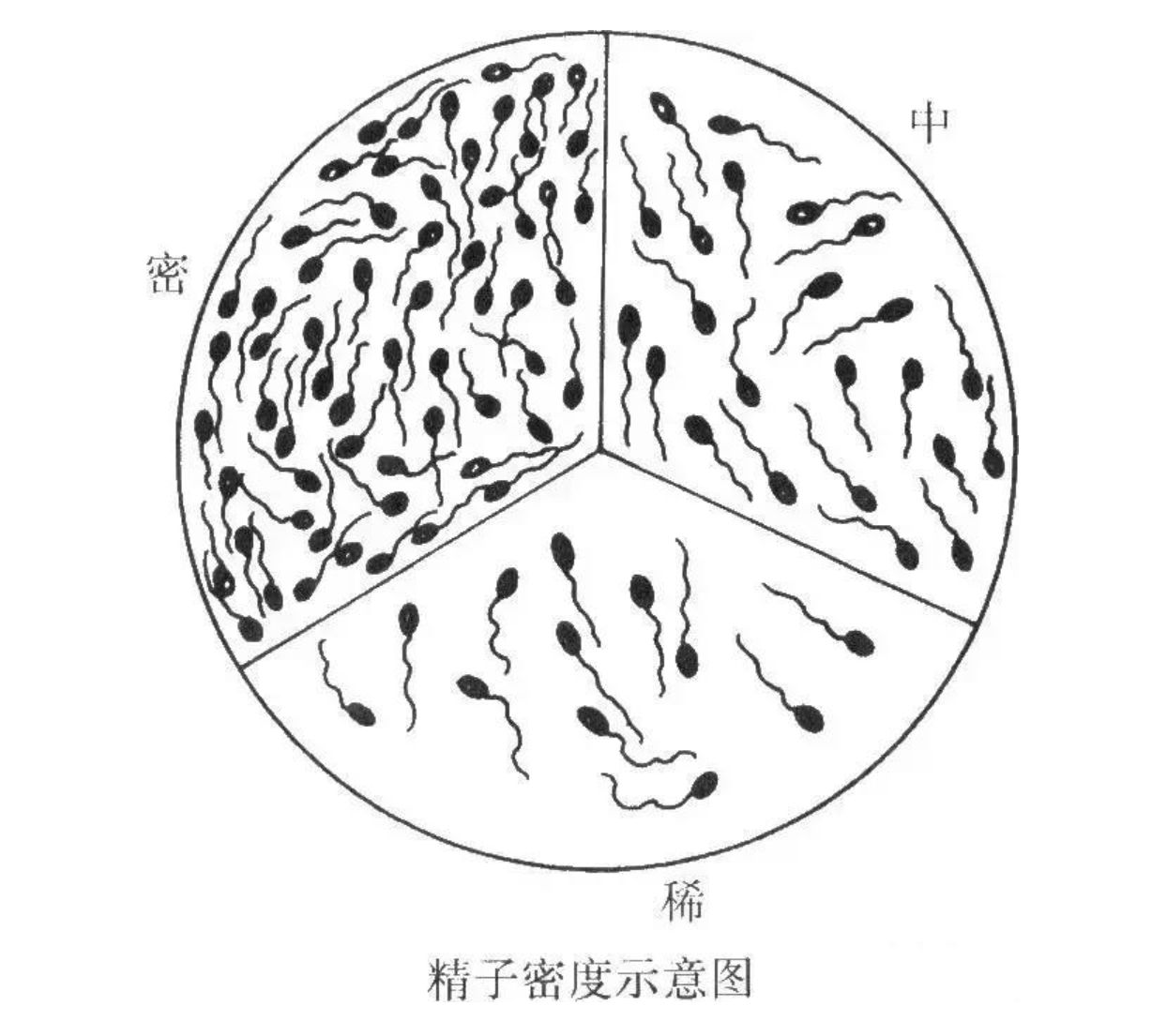 主要指标有：精液量、颜色、气味、精子密度、精子活力、精子畸形率等。