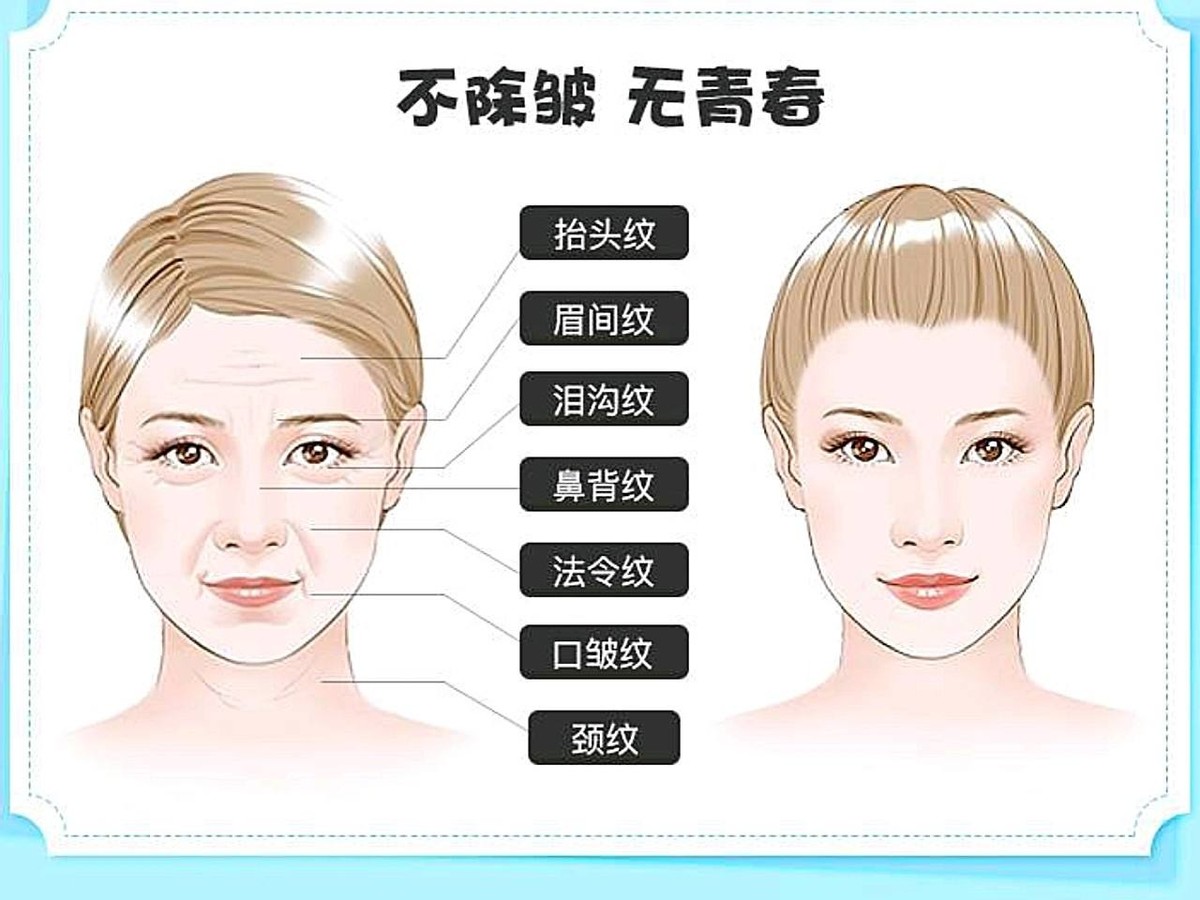 科普:注射肉毒素除皱效果好吗?注射肉毒素除皱效果能维持多久?