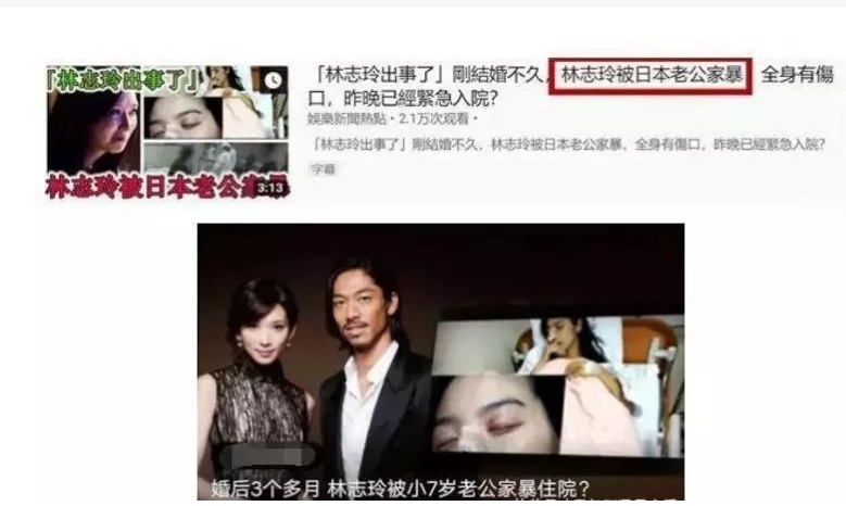 回顾林志玲被家暴流出疑似假体被打出回国修复日本老公出轨