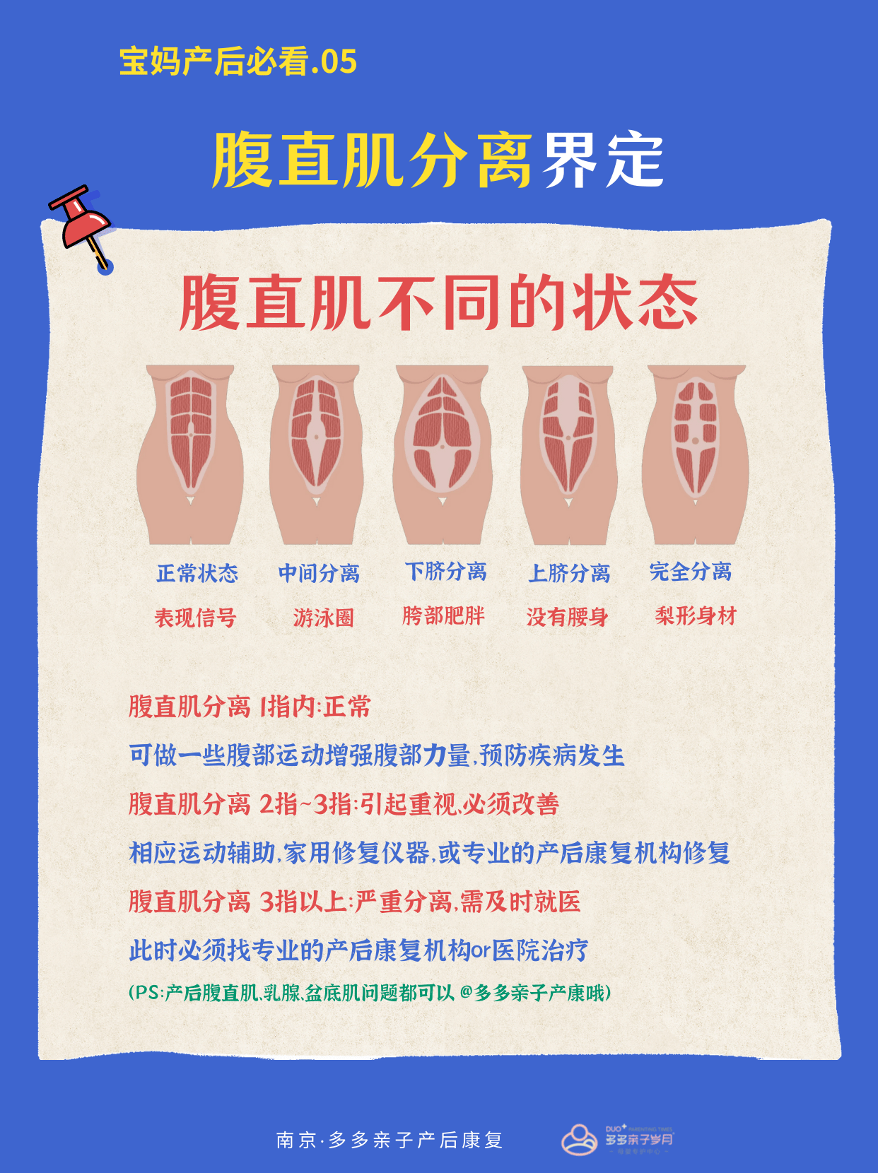 腹直肌分离自测图解图片