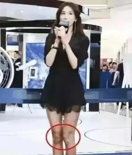 回顾林志玲被家暴流出疑似假体被打出回国修复日本老公出轨