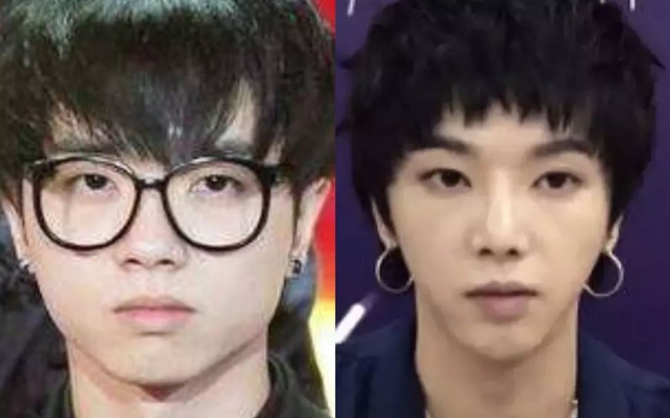 嘴歪,青蛙脸,削骨,僵硬浮肿这些"动脸"的男明星不害怕吗?