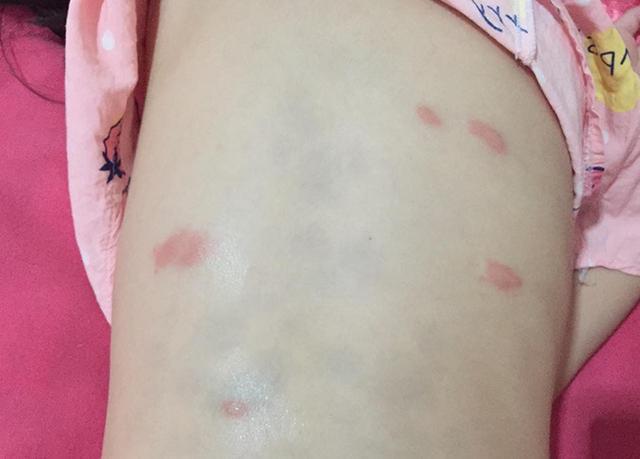 螨虫最怕的不是暴晒?教你一个小窍门,不用洗不用晒,让螨虫消失