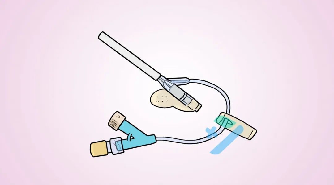 急!外周静脉留置针怎么都拔不出来,怎么办?