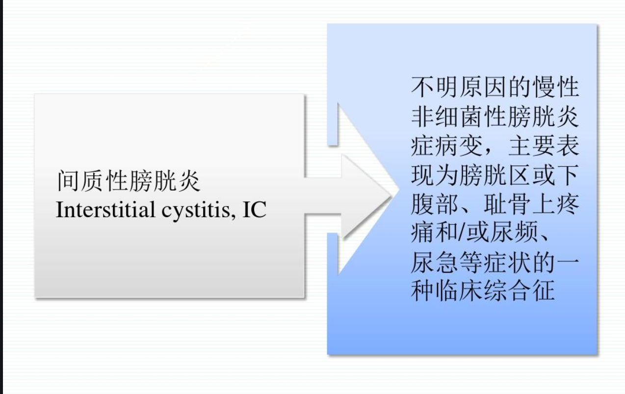 间质性膀胱炎,累及膀胱全层的慢性炎性疾病,又称膀胱疼痛综合征