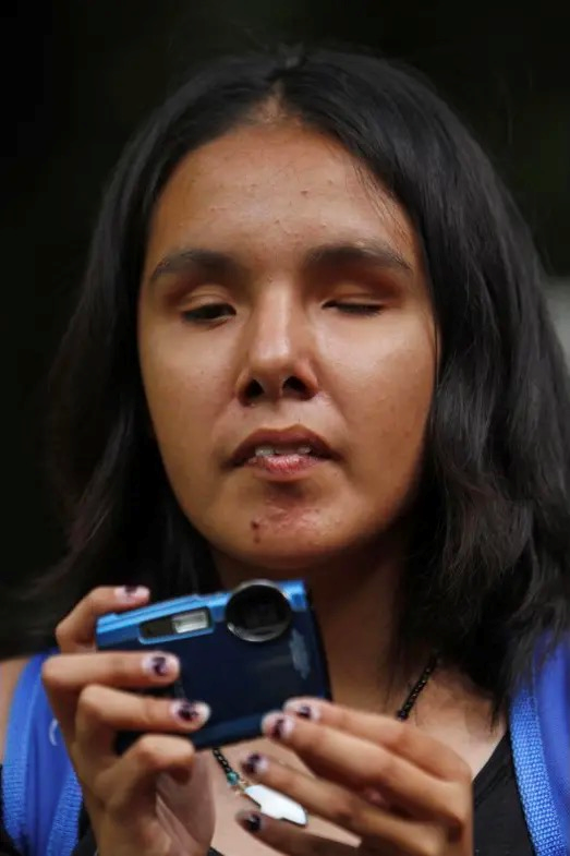 为什么不建议单眼盲做角膜移植?