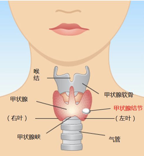 儿童甲状腺图片和症状图片