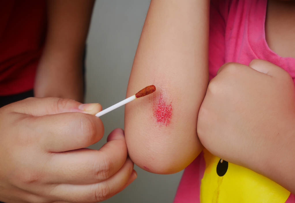 伤口结痂后,孩子总是忍不住去抠,怎么办?