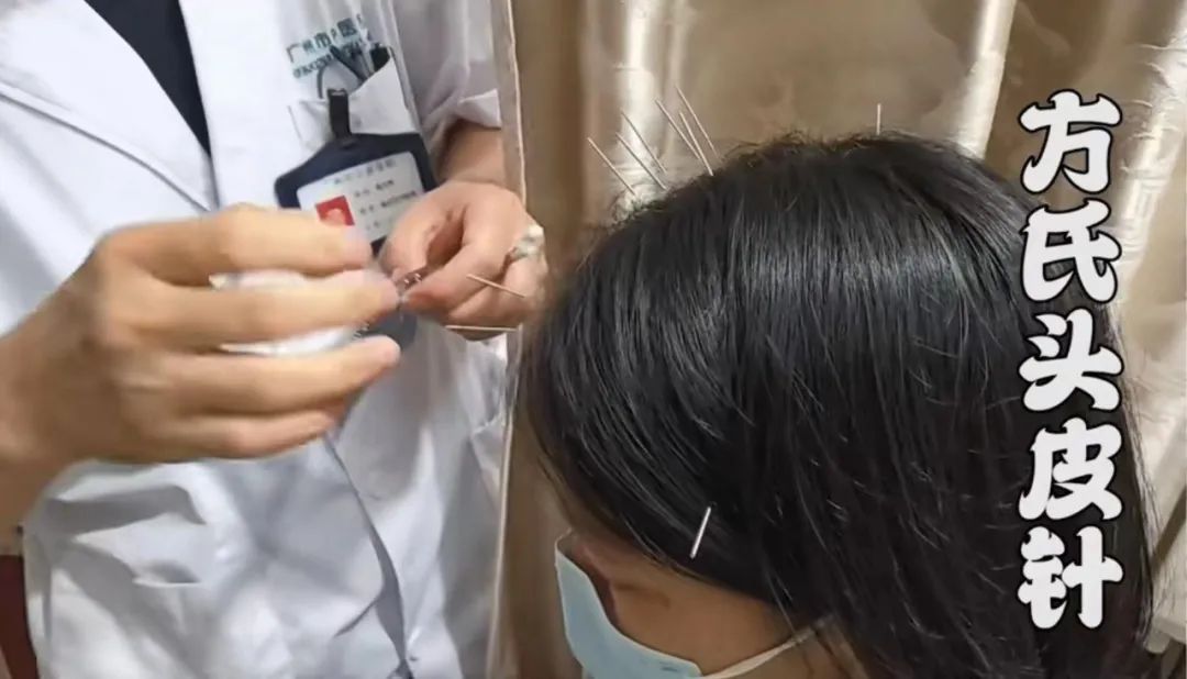 陕西名老中医方云鹏,独创"方氏头皮针",在国内外享有盛名