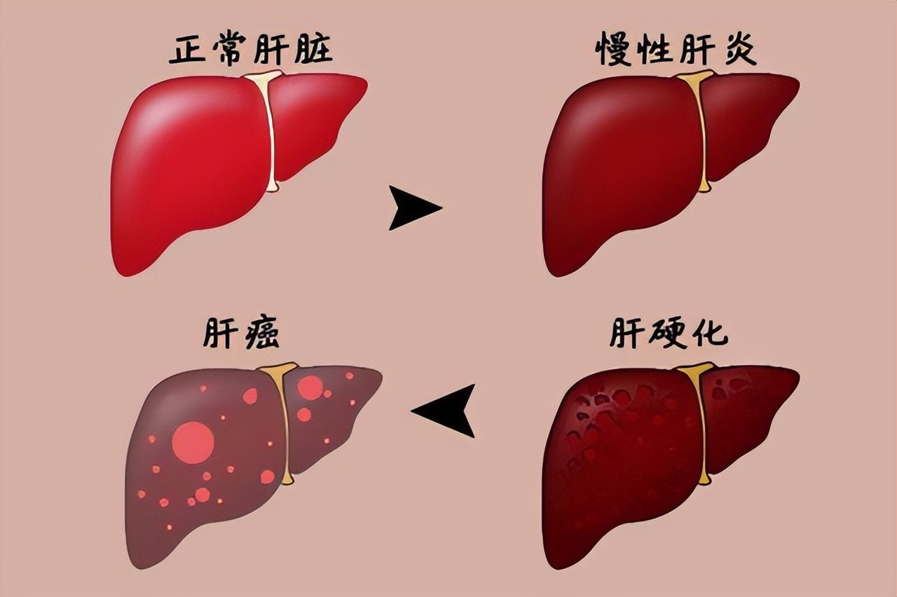 癌症发作前有信号