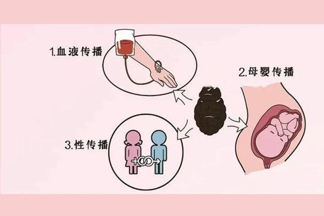 梅毒乳房图片