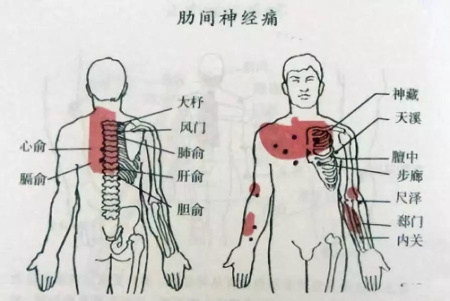 左侧肋骨疼痛位置图图片