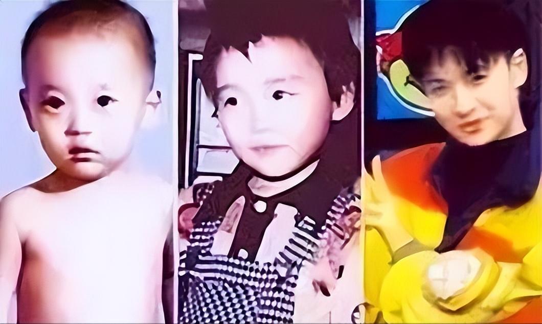 回顾变性人河莉秀:被丈夫抛弃,后遗症明显,身体不如80岁老太太