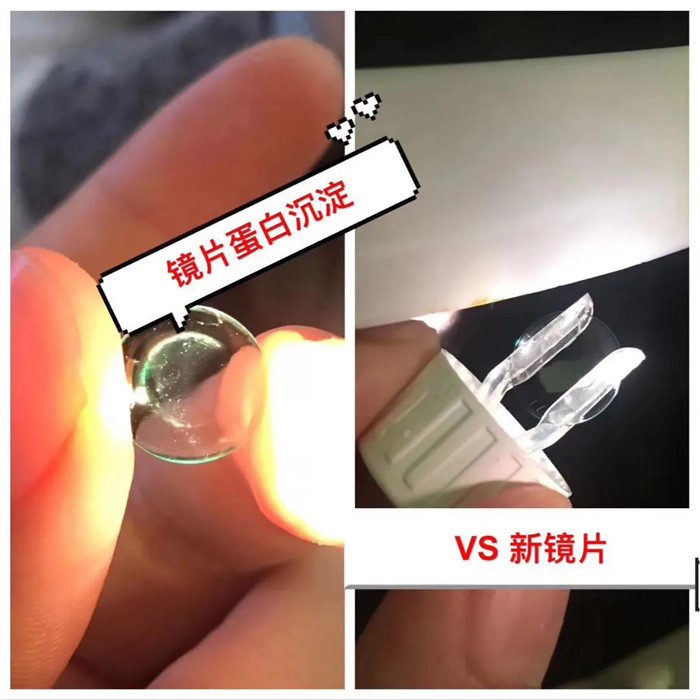 ok镜换片指南|你的ok镜还ok吗?明基医院太学眼科来支招