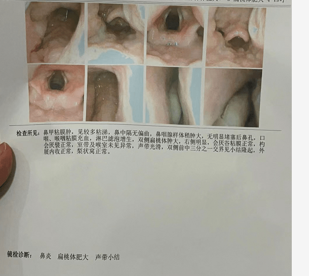 箹诗工坊:健康问答|烫伤红肿一定要口服激素吗?