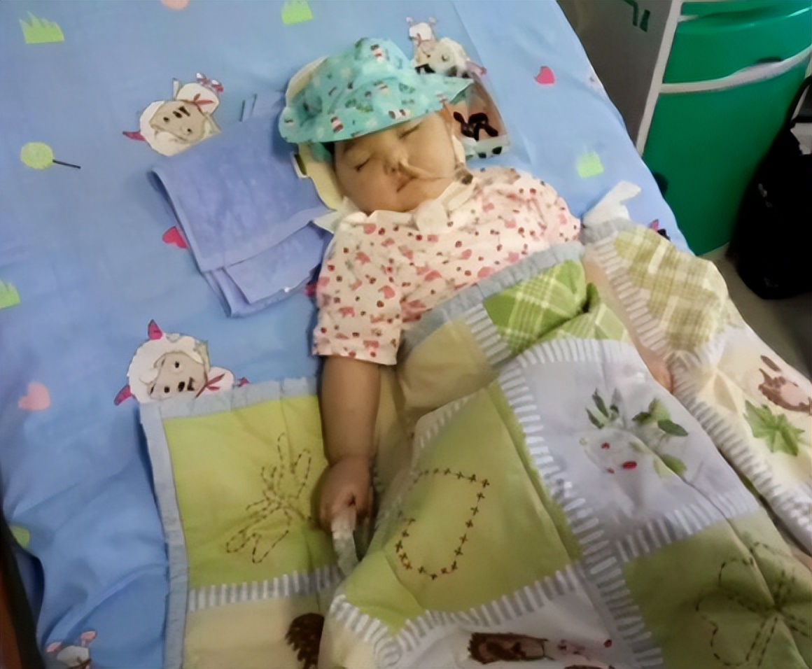 纪实:一岁半遭烟头烫腿,经历四次心脏骤停的小辛怡,怎么样了?