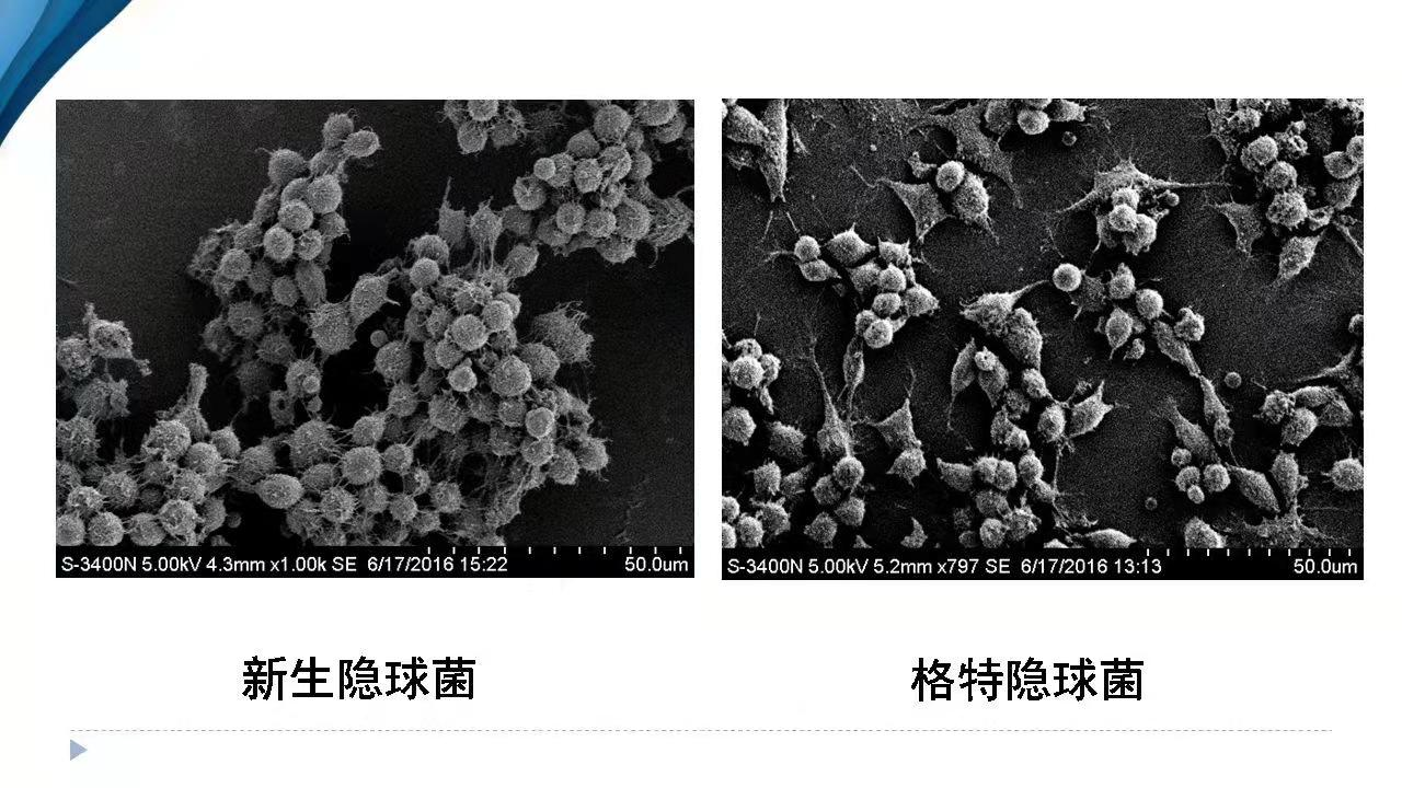 肺隐球菌病,1种少见的真菌感染,医生趣味解读