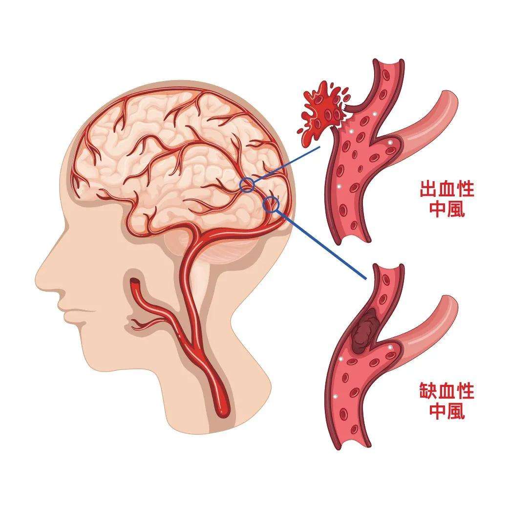 头皮干动脉图片