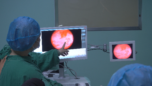 刚做完内窥镜可视无痛人流术第三天,给姐妹们讲讲我的亲身体验!