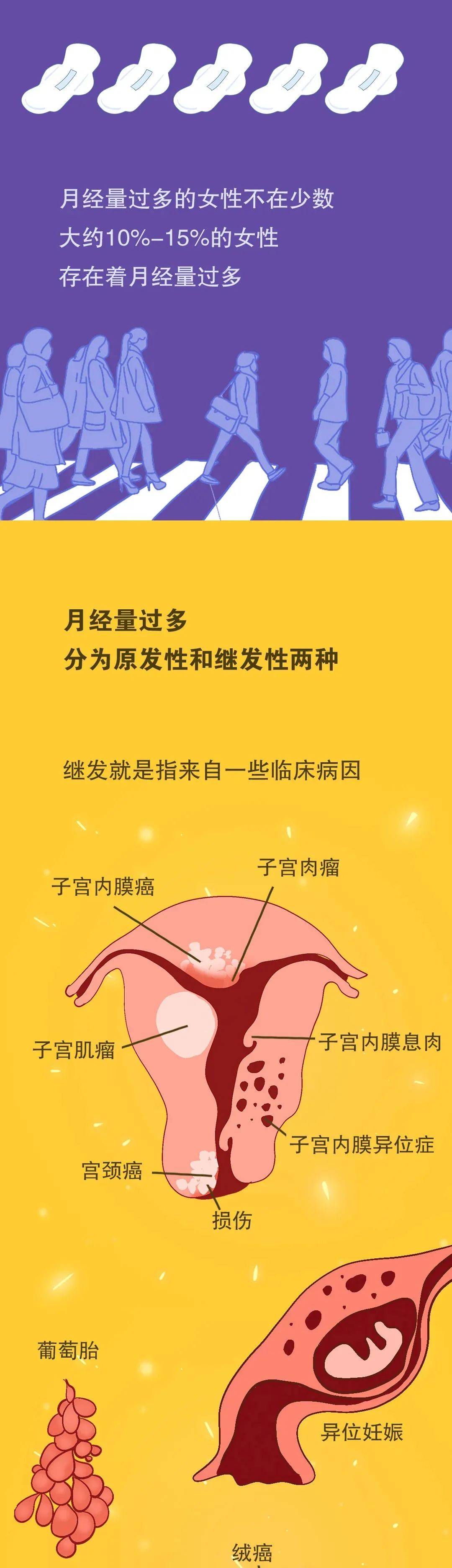 女生大姨妈量多说明什么?一组图告诉你月经量多和量少的原因