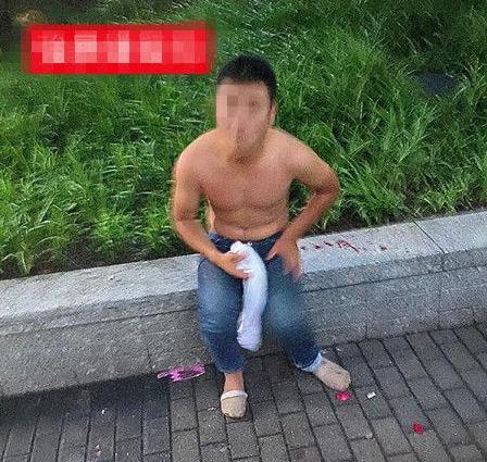 热点|男子阻止性侵案却被咬掉耳朵，医生说无法修复需开颅，嫌疑人仍在逃