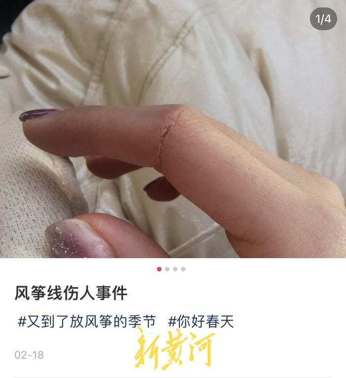 风筝线伤人事件频现,市民放风筝应绷紧"安全弦"