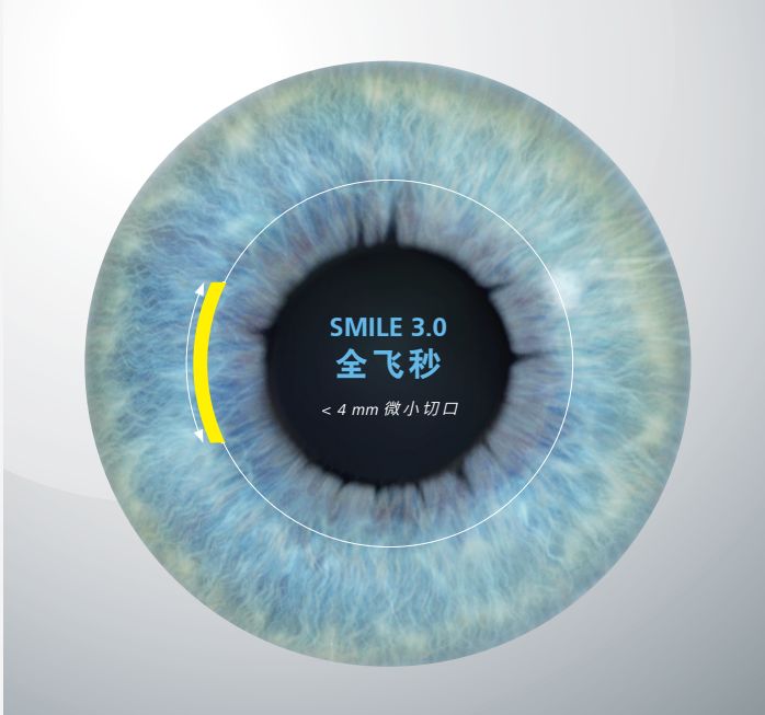 全飞秒和全激光有什么不同!