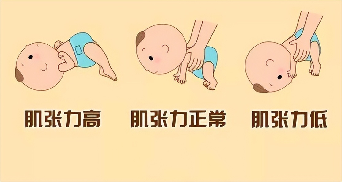 肌张力是什么意思 baijiahao.baidu.com