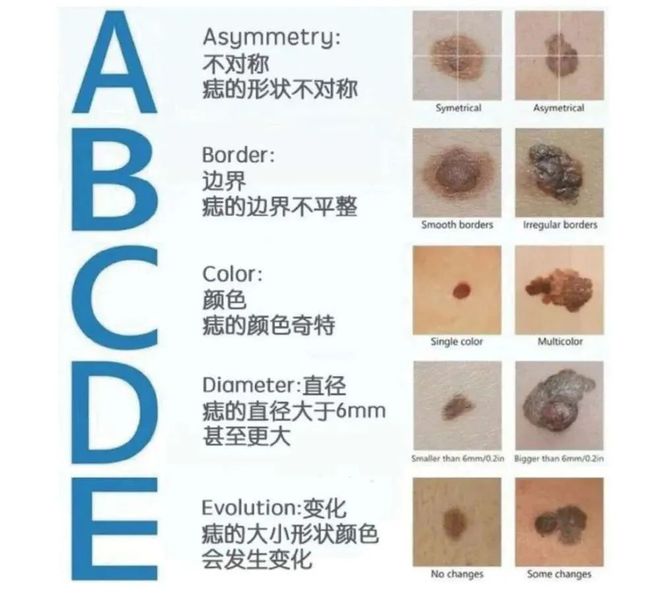 如果早点注意到胸上的这颗痣,也许她就不会这么遗憾退场了