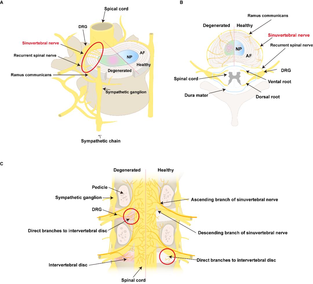 《ageing research reviews》杂志发表综述阐述神经源性椎