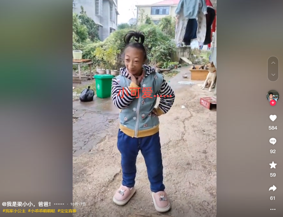 14年前湖南夫妇生下"小猴子",差点被杂技团买走,现在孩子咋样了