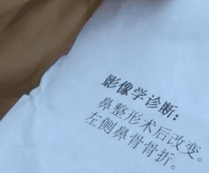 贷款6万的鼻子被撞断,修理费又要6万,车贷还不知道多少