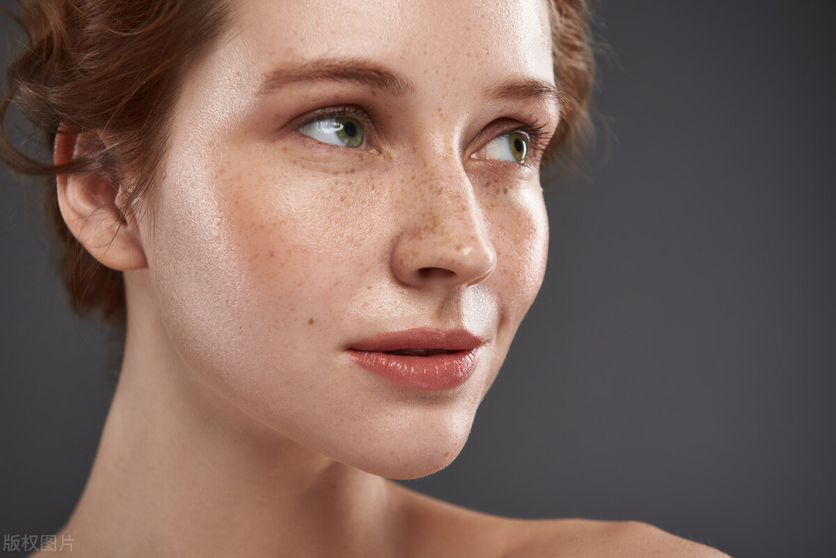 长斑的女生们必看