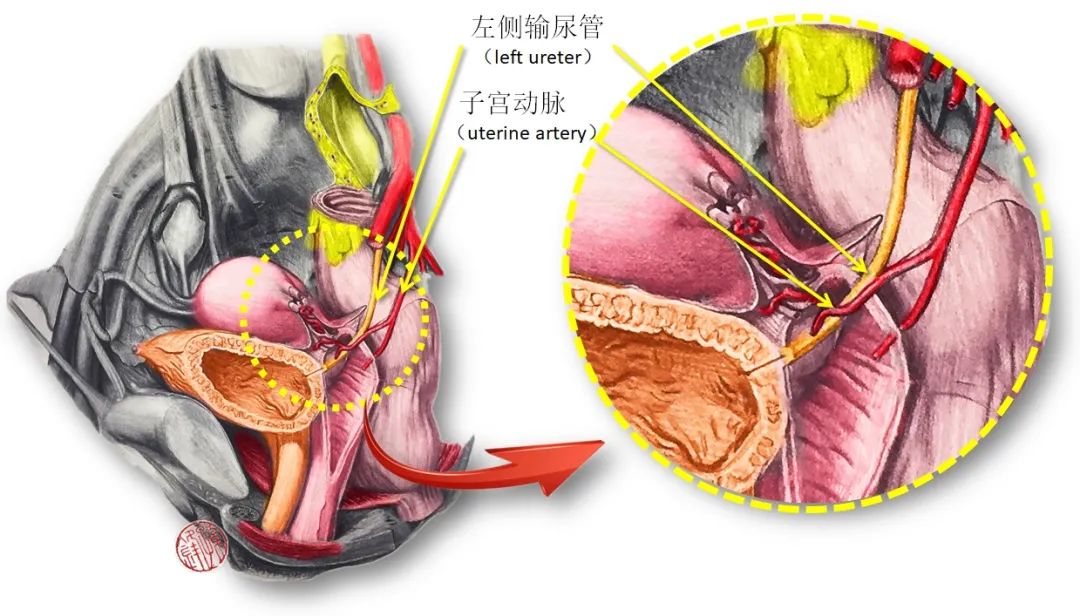 医学图说︱子宫动脉与输尿管