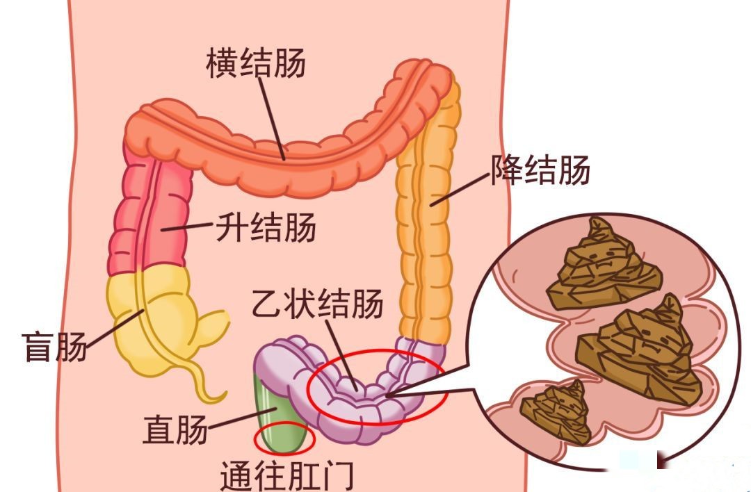 关于宝宝便秘对身体的影响,这4种情况,爸妈一定要提前知道