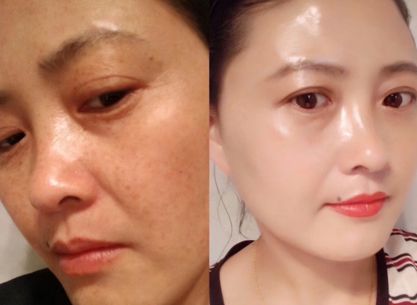 女生的皮肤暗黄粗糙,原因不只是熬夜,还有这几点要注意