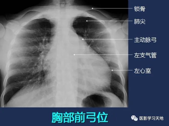 「收藏」全身x线图谱,阅片必备!
