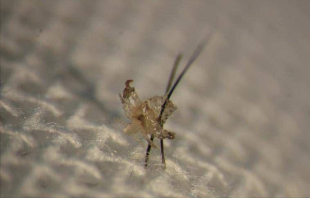 6岁女童睫毛长满"虱子",从何而来?为何"返祖"满身爬