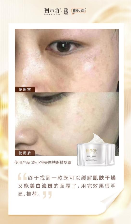 斑小将为何成美白界新宠?